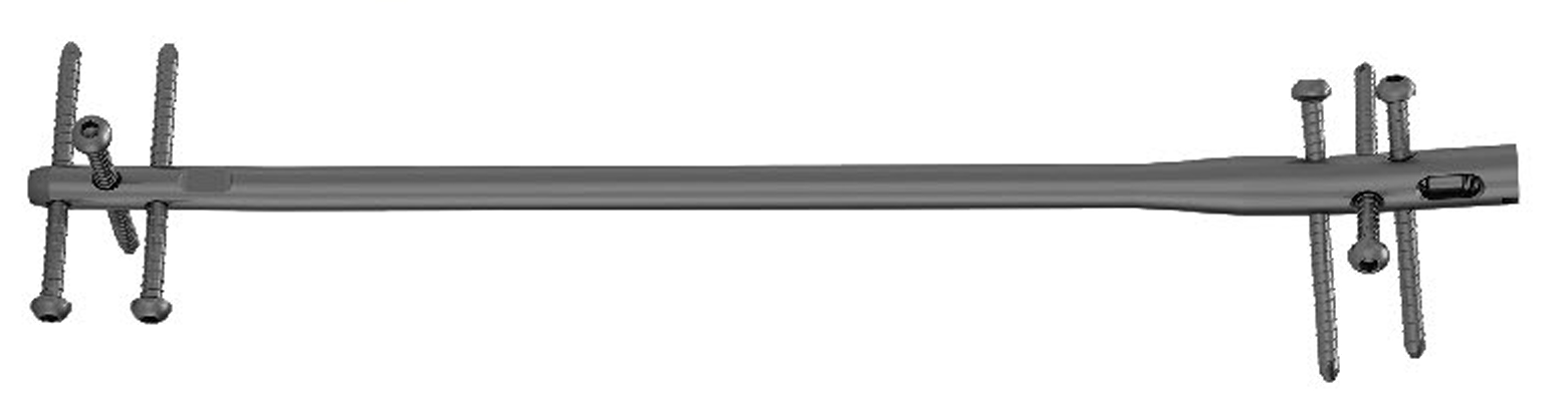 Блокуючий стержень для великогомілкової кістки (надпателярний доступ) UMP